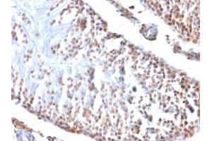 Formalin-fixed, paraffin-embedded Rat Testis stained with Wilm's Tumor Mouse Monoclonal Antibody (6F-H2). (WT1 anticorps  (AA 1-181))