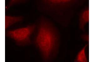 Immunofluorescence staining of methanol-fixed HeLa cells using MDM2 polyclonal antibody (Cat # PAB12253, Red). (MDM2 anticorps  (Ser166))
