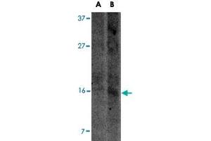Western blot analysis of UCMA in SW1353 cell lysate with UCMA polyclonal antibody  at (A) 2. (UCMA anticorps  (C-Term))