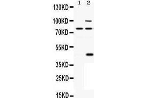 Observed bind size: 80KD, 45/80/100KD (PCSK6 anticorps  (C-Term))