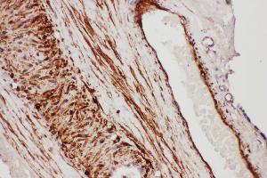 Anti- TFPI antibody, IHC(P) IHC(P): Human Placenta Tissue (TFPI anticorps  (N-Term))