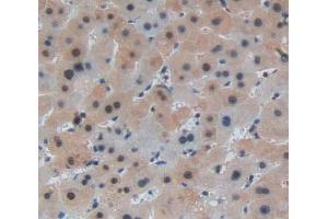 Used in DAB staining on fromalin fixed paraffin- embedded Kidney tissue (Leucine Rich Repeats And Death Domain Containing Protein (AA 694-885) anticorps)