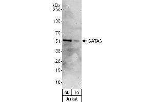 Western Blotting (WB) image for anti-GATA Binding Protein 3 (GATA3) (AA 150-200) antibody (ABIN7454559)