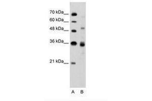 Image no. 1 for anti-CUGBP, Elav-Like Family Member 3 (CELF3) (N-Term) antibody (ABIN6736325)