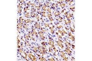 Immunohistochemistry of paraffin embedded rat stomach using SLC7A8 (ABIN7074503) at dilution of 1:1100 (400x lens)
