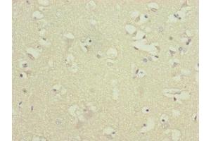 Immunohistochemistry of paraffin-embedded human brain tissue using ABIN7144847 at dilution of 1:100