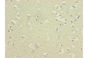 Immunohistochemistry of paraffin-embedded human brain tissue using ABIN7144847 at dilution of 1:100 (ATP5F1D anticorps  (AA 1-168))