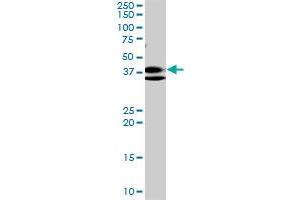 RNF2 monoclonal antibody (M01), clone 6C2.
