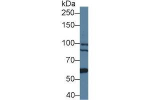 Western Blot; Sample: Human 293T cell lysate; Primary Ab: 1µg/ml Rabbit Anti-Mouse BCOR Antibody Second Ab: 0.