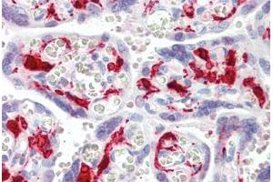 Human Placenta (formalin-fixed, paraffin-embedded) stained with F13A1 antibody ABIN461969 at 5 ug/ml followed by biotinylated secondary antibody, alkaline phosphatase-streptavidin and chromogen. (F13A1 anticorps)