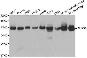 Western blot analysis of extracts of various cell lines, using ALDOA antibody. (ALDOA anticorps  (AA 1-348))