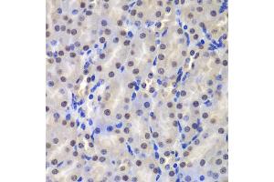 Immunohistochemistry of paraffin-embedded mouse kidney using GSTP1 antibody (ABIN5973328) at dilution of 1/200 (40x lens). (GSTP1 anticorps)