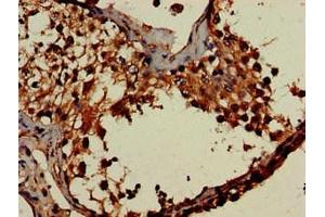 anti-DOT1-Like, Histone H3 Methyltransferase (S. Cerevisiae) (DOT1L) (AA 331-484) antibody