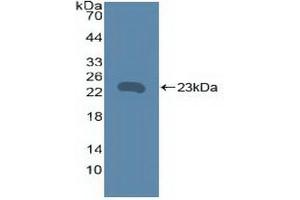 Detection of Recombinant TNFRSF5, Human using Polyclonal Antibody to Tumor Necrosis Factor Receptor Superfamily, Member 5 (CD40) (CD40 anticorps  (AA 26-187))