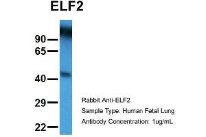 Host:  Rabbit  Target Name:  ELF2  Sample Type:  Human Fetal Lung  Antibody Dilution:  1. (ELF2 anticorps  (N-Term))