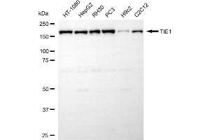 anti-tyrosine Kinase with Immunoglobulin-Like and EGF-Like Domains 1 (TIE1) antibody