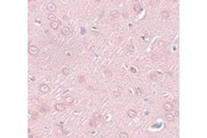 Immunohistochemistry (IHC) image for anti-Synaptogyrin 2 (SYNGR2) (N-Term) antibody (ABIN1031591) (SYNGR2 anticorps  (N-Term))