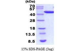 SDS-PAGE (SDS) image for Phosphoglycerate Kinase 1 (PGK1) (AA 1-417) (Active) protein (His tag) (ABIN6387707) (PGK1 Protein (AA 1-417) (His tag))