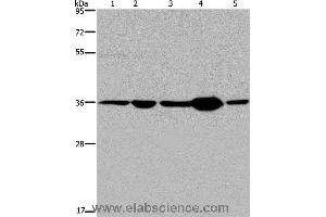 Western blot analysis of Human transitional cell carcinoma tissue, 293T and A172 cell, human testis tissue and Hela cell, using LZTFL1 Polyclonal Antibody at dilution of 1:550