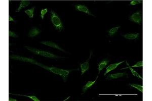 Immunofluorescence of monoclonal antibody to FH on HeLa cell.