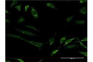 Immunofluorescence of monoclonal antibody to FH on HeLa cell. (FH anticorps  (AA 33-510))