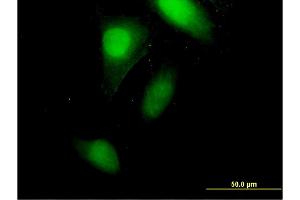 Immunofluorescence of monoclonal antibody to CRABP2 on HeLa cell. (CRABP2 anticorps  (AA 1-138))