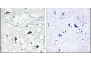 Immunohistochemistry analysis of paraffin-embedded human brain tissue, using Caspase 3 (Cleaved-Asp175) Antibody. (Caspase 3 anticorps  (Cleaved-Asp175))
