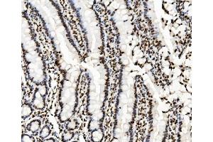 IHC analysis of KAP1/TRIM28 using anti-KAP1/TRIM28 antibody (ABIN7602310). (KAP1 anticorps  (AA 699-835))