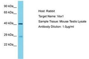 Image no. 1 for anti-Visual System Homeobox 1 (VSX1) (AA 282-331) antibody (ABIN6750281) (VSX1 anticorps  (AA 282-331))