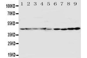 Anti-HDJ2 antibody, Western blottingAll lanes: Anti HDJ2  at 0. (DNAJA1 anticorps  (C-Term))