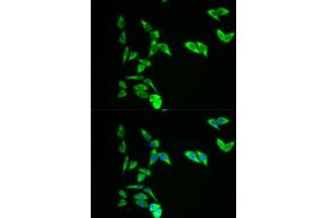 Immunofluorescence analysis of A549 cells using AK1 antibody.