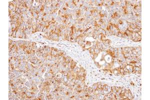 IHC-P Image Immunohistochemical analysis of paraffin-embedded SW480 xenograft, using NNT, antibody at 1:100 dilution.