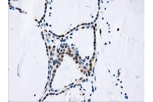 Immunohistochemical staining of paraffin-embedded liver tissue using anti-DCXRmouse monoclonal antibody. (DCXR anticorps)