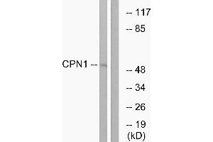 Western blot analysis of extracts from RAW264. (CPN1 anticorps)