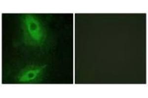 Immunofluorescence analysis of HeLa cells, using TNFSF15 antibody.