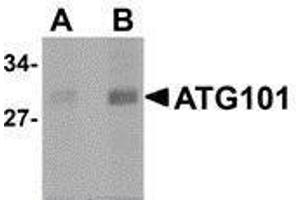 Western Blotting (WB) image for anti-Chromosome 12 Open Reading Frame 44 (C12orf44) (Center) antibody (ABIN2477522) (ATG101 anticorps  (Center))