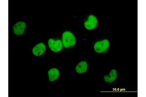 Immunofluorescence of monoclonal antibody to FKBP5 on HeLa cell. (FKBP5 anticorps  (AA 1-457))