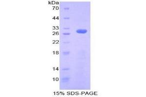 SDS-PAGE analysis of Human Ribonuclease Inhibitor Protein. (RNH1 Protéine)