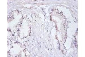 Immunohistochemistry of paraffin-embedded human prostate tissue using ABIN7167685 at dilution of 1:100 (RPA3 anticorps  (AA 1-119))