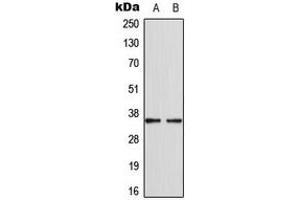 Western blot analysis of CDKL4 expression in MCF7 (A), HepG2 (B) whole cell lysates. (CDKL4 anticorps  (C-Term))