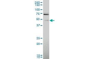 PVRL1 polyclonal antibody (A01), Lot # 050913JC01 Western Blot analysis of PVRL1 expression in A-431 .