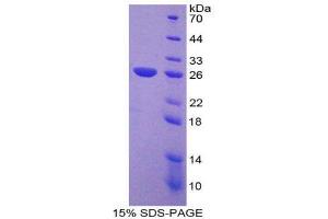 SDS-PAGE (SDS) image for Nucleoporin 133kDa (NUP133) (AA 899-1091) protein (His tag) (ABIN1879630)