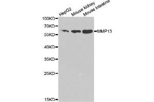 Western blot analysis of extracts of various cell lines, using MMP13 antibody. (MMP13 anticorps  (AA 262-471))