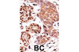 Immunohistochemistry (IHC) image for anti-C-Abl Oncogene 1, Non-Receptor tyrosine Kinase (ABL1) (pTyr412) antibody (ABIN3001744) (ABL1 anticorps  (pTyr412))