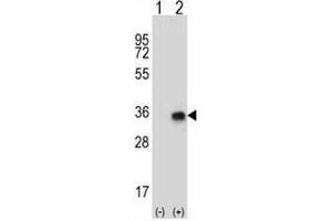 Western blot analysis of CNOT8 (arrow) using rabbit polyclonal CNOT8 Antibody (N-term) . (CNOT8 anticorps  (N-Term))