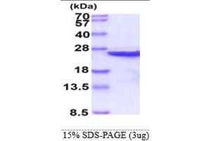 SDS-PAGE (SDS) image for Calcium and Integrin-Binding Protein 1 (CIB1) (AA 1-191) protein (His tag) (ABIN666637)