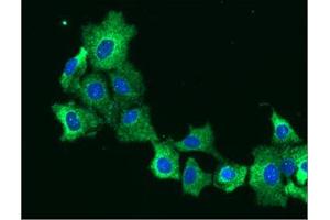 ICC/IF analysis of EPHX1 in Hep3B cells line, stained with DAPI (Blue) for nucleus staining and monoclonal anti-human EPHX1 antibody (1:100) with goat anti-mouse IgG-Alexa fluor 488 conjugate (Green).