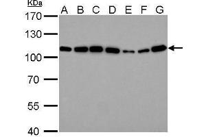 WB Image alpha Actinin 4 antibody [C2C3], C-term detects ACTN4 protein by Western blot analysis.