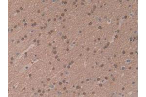 IHC-P analysis of Human Brain Tissue, with DAB staining. (MTOR anticorps  (AA 2226-2488))