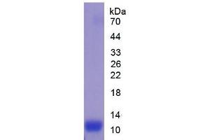 SDS-PAGE analysis of Mouse IL13Ra2 Protein. (IL13RA2 Protéine)